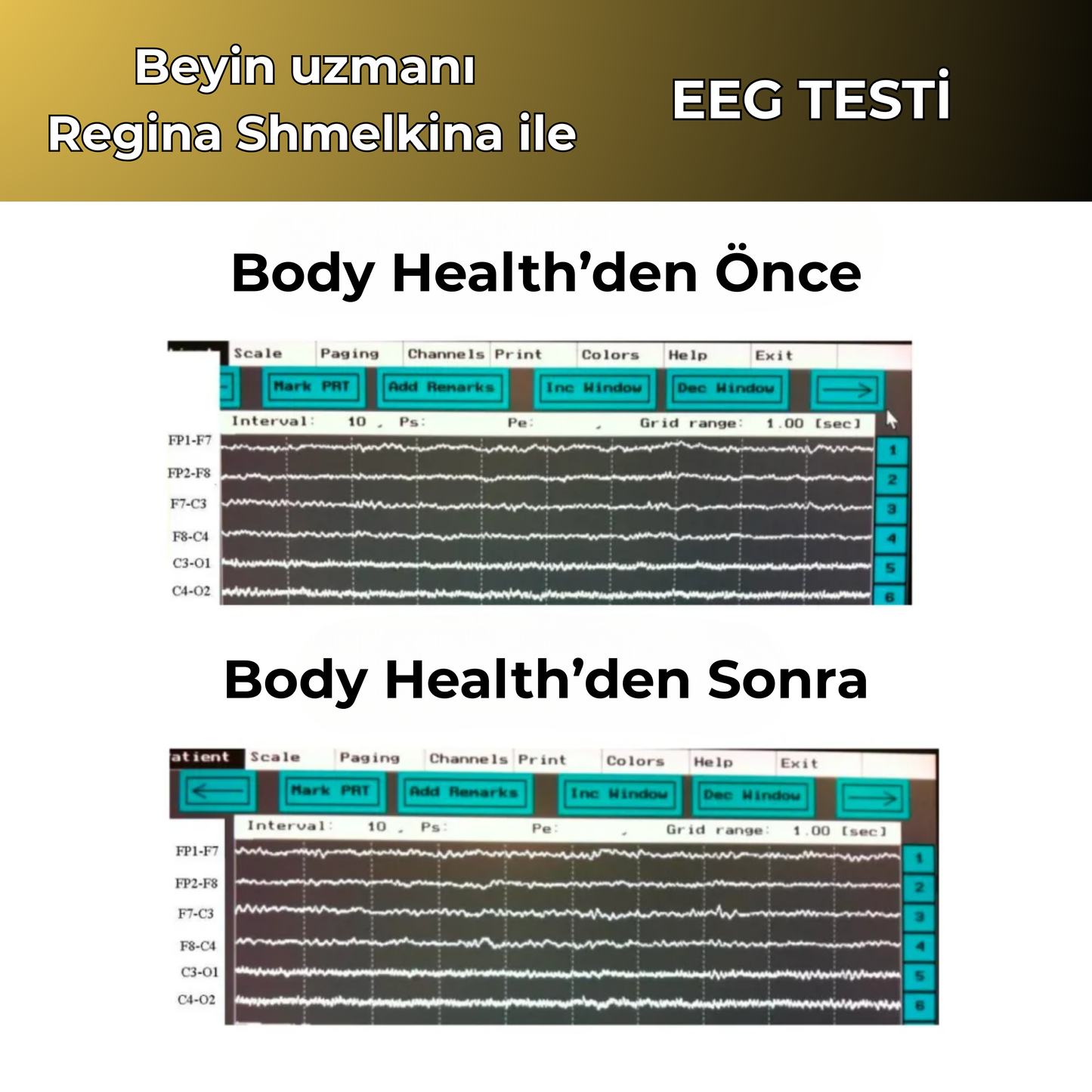 2'li Body Health - Sağlık Çipi